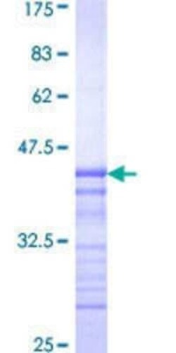 Novus Biologicals Recombinant Human PASK GST (N-Term) Protein 25 &mu;g | Buy Online | Novus Biologicals&trade; | Fisher Scientific