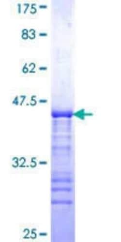 Novus Biologicals Recombinant Human DIP2A GST (N-Term) Protein 25 &mu;g | Buy Online | Novus Biologicals&trade; | Fisher Scientific