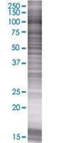 Novus Biologicals DIP2A 293T Cell Transient Overexpression Lysate 0.1 mL | Buy Online | Novus Biologicals&trade; | Fisher Scientific
