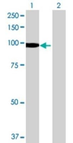 Novus Biologicals DIP2A 293T Cell Transient Overexpression Lysate 0.1 mL | Buy Online | Novus Biologicals&trade; | Fisher Scientific