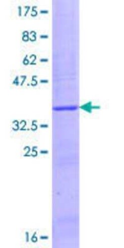 Novus Biologicals Recombinant Human CYFIP1 GST (N-Term) Protein 25 &mu;g | Buy Online | Novus Biologicals&trade; | Fisher Scientific