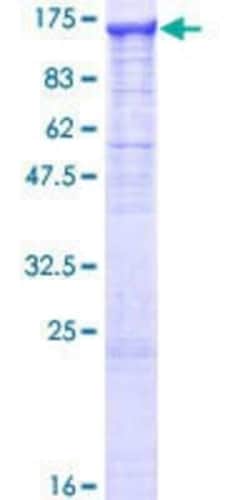 Novus Biologicals Recombinant Human alpha Glucosidase 2 GST (N-Term) Protein 10 &mu;g | Buy Online | Novus Biologicals&trade; | Fisher Scientific