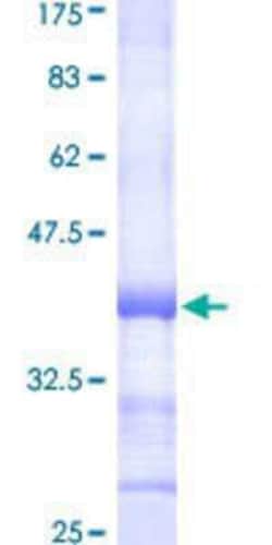 Novus Biologicals Recombinant Human alpha Glucosidase 2 GST (N-Term) Protein 25 &mu;g | Buy Online | Novus Biologicals&trade; | Fisher Scientific