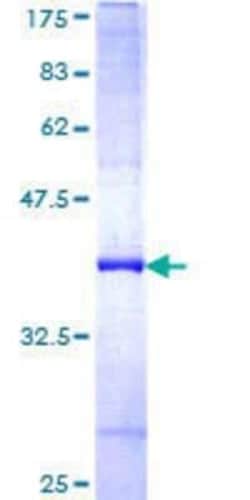 Novus Biologicals&trade;&nbsp;Recombinant Human FBXL7 GST (N-Term) Protein