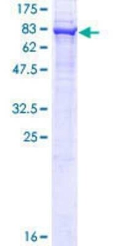Novus Biologicals Recombinant Human ETEA GST (N-Term) Protein 25 &mu;g | Buy Online | Novus Biologicals&trade; | Fisher Scientific