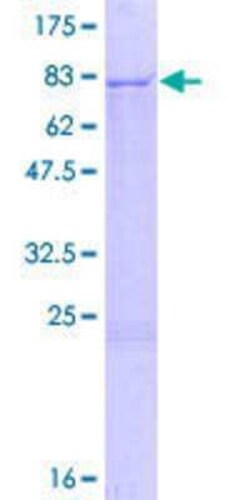 Novus Biologicals Recombinant Human PMPCA GST (N-Term) Protein 2 &mu;g | Buy Online | Novus Biologicals&trade; | Fisher Scientific