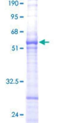 Novus Biologicals Recombinant Human ARMER GST (N-Term) Protein 10 &mu;g | Buy Online | Novus Biologicals&trade; | Fisher Scientific