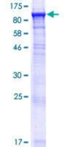 Novus Biologicals Recombinant Human ACSBG1 GST (N-Term) Protein 10 &mu;g | Buy Online | Novus Biologicals&trade; | Fisher Scientific