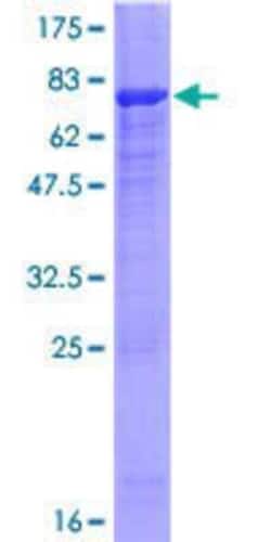 Novus Biologicals&trade;&nbsp;Recombinant Human PLEKHM2 GST (N-Term) Protein