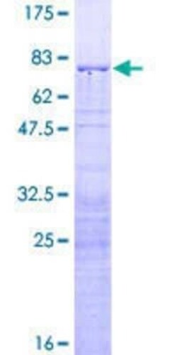 Novus Biologicals Recombinant Human RRS1 GST (N-Term) Protein 2 &mu;g | Buy Online | Novus Biologicals&trade; | Fisher Scientific