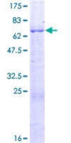 Novus Biologicals Recombinant Human FBXO28 GST (N-Term) Protein 2 &mu;g | Buy Online | Novus Biologicals&trade; | Fisher Scientific