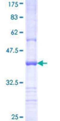 Novus Biologicals Recombinant Human RHOBTB2 GST (N-Term) Protein 25 &mu;g | Buy Online | Novus Biologicals&trade; | Fisher Scientific