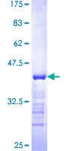 Novus Biologicals Recombinant Human Nesprin 2 GST (N-Term) Protein 10 &mu;g | Buy Online | Novus Biologicals&trade; | Fisher Scientific