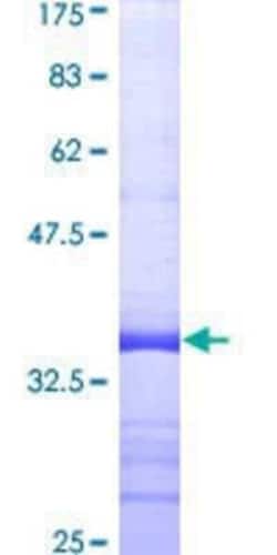 Novus Biologicals Recombinant Human PLCL2 GST (N-Term) Protein 10 &mu;g | Buy Online | Novus Biologicals&trade; | Fisher Scientific