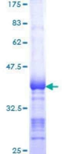 Novus Biologicals Recombinant Human SNF1LK2/SIK2 GST (N-Term) Protein 25 &mu;g | Buy Online | Novus Biologicals&trade; | Fisher Scientific