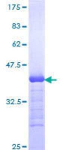 Novus Biologicals Recombinant Human PLC-beta 1 GST (N-Term) Protein 10 &mu;g | Buy Online | Novus Biologicals&trade; | Fisher Scientific