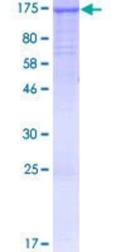Novus Biologicals Recombinant Human PACS2 GST (N-Term) Protein 25 &mu;g | Buy Online | Novus Biologicals&trade; | Fisher Scientific