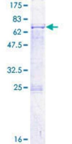 Novus Biologicals Recombinant Human SCC112 GST (N-Term) Protein 2 &mu;g | Buy Online | Novus Biologicals&trade; | Fisher Scientific