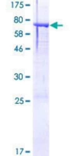 Novus Biologicals Recombinant Human ASTN2 GST (N-Term) Protein 25 &mu;g | Buy Online | Novus Biologicals&trade; | Fisher Scientific