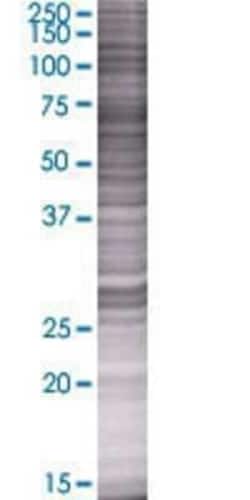 Novus Biologicals RPRD2 293T Cell Transient Overexpression Lysate 0.1 mL | Buy Online | Novus Biologicals&trade; | Fisher Scientific