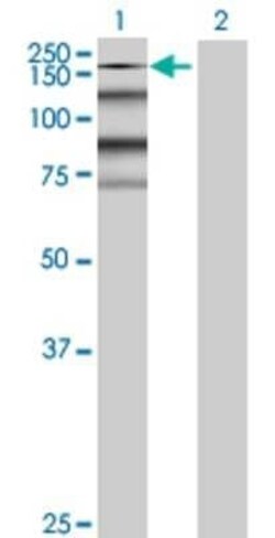 Novus Biologicals RPRD2 293T Cell Transient Overexpression Lysate 0.1 mL | Buy Online | Novus Biologicals&trade; | Fisher Scientific