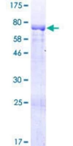 Novus Biologicals Recombinant Human Kazrin GST (N-Term) Protein 10 &mu;g | Buy Online | Novus Biologicals&trade; | Fisher Scientific