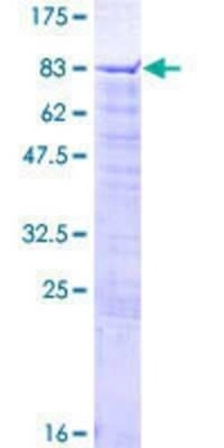 Novus Biologicals Recombinant Human SCFD1 GST (N-Term) Protein 2 &mu;g | Buy Online | Novus Biologicals&trade; | Fisher Scientific