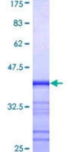 Novus Biologicals Recombinant Human MCF2L GST (N-Term) Protein 10 &mu;g | Buy Online | Novus Biologicals&trade; | Fisher Scientific