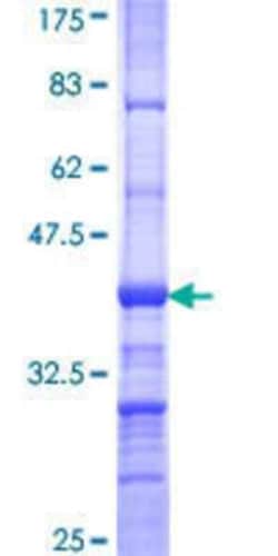Novus Biologicals Recombinant Human EXOC7 GST (N-Term) Protein 10 &mu;g | Buy Online | Novus Biologicals&trade; | Fisher Scientific