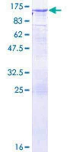 Novus Biologicals Recombinant Human DNMBP GST (N-Term) Protein 10 &mu;g | Buy Online | Novus Biologicals&trade; | Fisher Scientific