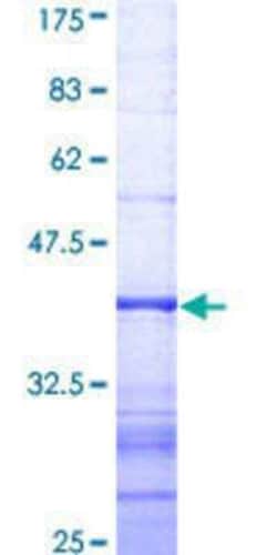 Novus Biologicals Recombinant Human DNMBP GST (N-Term) Protein 25 &mu;g | Buy Online | Novus Biologicals&trade; | Fisher Scientific