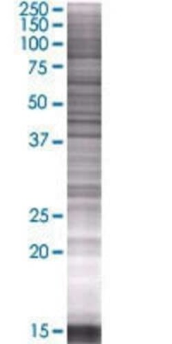 Novus Biologicals MTUS2 293T Cell Transient Overexpression Lysate 0.1 mL | Buy Online | Novus Biologicals&trade; | Fisher Scientific
