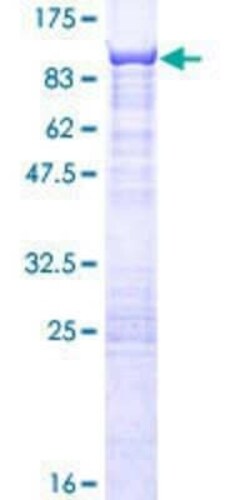 Novus Biologicals Recombinant Human CSTF2T GST (N-Term) Protein 10 &mu;g | Buy Online | Novus Biologicals&trade; | Fisher Scientific