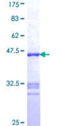 Novus Biologicals Recombinant Human AGTPBP1 GST (N-Term) Protein 10 &mu;g | Buy Online | Novus Biologicals&trade; | Fisher Scientific