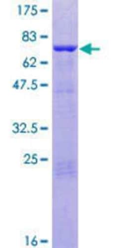 Novus Biologicals Recombinant Human ANKS1A GST (N-Term) Protein 10 &mu;g | Buy Online | Novus Biologicals&trade; | Fisher Scientific