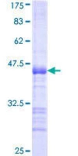 Novus Biologicals Recombinant Human MGRN1 GST (N-Term) Protein 25 &mu;g | Buy Online | Novus Biologicals&trade; | Fisher Scientific
