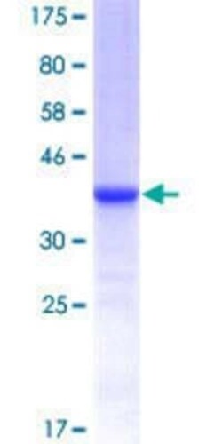 Novus Biologicals Recombinant Human KIF13B GST (N-Term) Protein 10 &mu;g | Buy Online | Novus Biologicals&trade; | Fisher Scientific