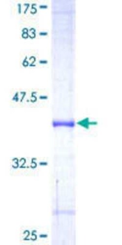 Novus Biologicals Recombinant Human UBR2 GST (N-Term) Protein 25 &mu;g | Buy Online | Novus Biologicals&trade; | Fisher Scientific