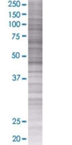 Novus Biologicals UBR2 293T Cell Transient Overexpression Lysate 0.1 mL | Buy Online | Novus Biologicals&trade; | Fisher Scientific