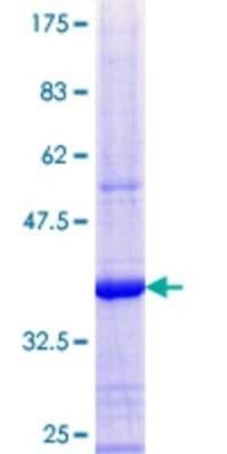 Novus Biologicals Recombinant Human SIN3B GST (N-Term) Protein 10 &mu;g | Buy Online | Novus Biologicals&trade; | Fisher Scientific