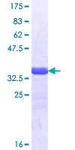 Novus Biologicals Recombinant Human CUTL2 GST (N-Term) Protein 25 &mu;g | Buy Online | Novus Biologicals&trade; | Fisher Scientific