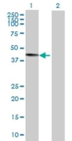 Novus Biologicals&trade;&nbsp;ZCCHC11/TUT4 293T Cell Transient Overexpression Lysate