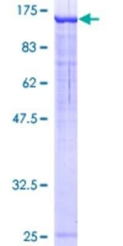 Novus Biologicals Recombinant Human NEDD4L GST (N-Term) Protein 10 &mu;g | Buy Online | Novus Biologicals&trade; | Fisher Scientific