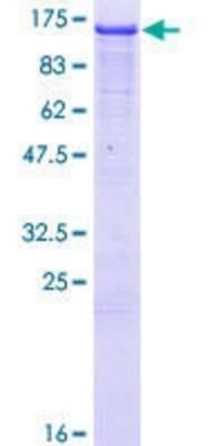 Novus Biologicals Recombinant Human NEDD4L GST (N-Term) Protein 10 &mu;g | Buy Online | Novus Biologicals&trade; | Fisher Scientific
