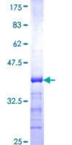 Novus Biologicals Recombinant Human CLASP1 GST (N-Term) Protein 25 &mu;g | Buy Online | Novus Biologicals&trade; | Fisher Scientific