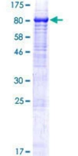Novus Biologicals Recombinant Human SZT2 GST (N-Term) Protein 10 &mu;g | Buy Online | Novus Biologicals&trade; | Fisher Scientific