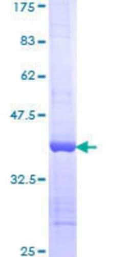 Novus Biologicals Recombinant Human SYNE1 GST (N-Term) Protein 25 &mu;g | Buy Online | Novus Biologicals&trade; | Fisher Scientific