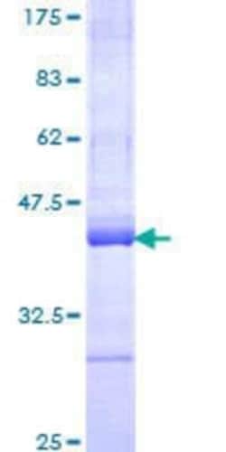 Novus Biologicals Recombinant Human UBR4 GST (N-Term) Protein 10 &mu;g | Buy Online | Novus Biologicals&trade; | Fisher Scientific