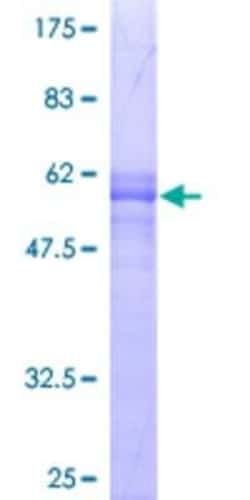 Novus Biologicals Recombinant Human SUN1 GST (N-Term) Protein 2 &mu;g | Buy Online | Novus Biologicals&trade; | Fisher Scientific