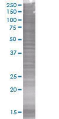 Novus Biologicals&trade;&nbsp;SUN1 293T Cell Transient Overexpression Lysate